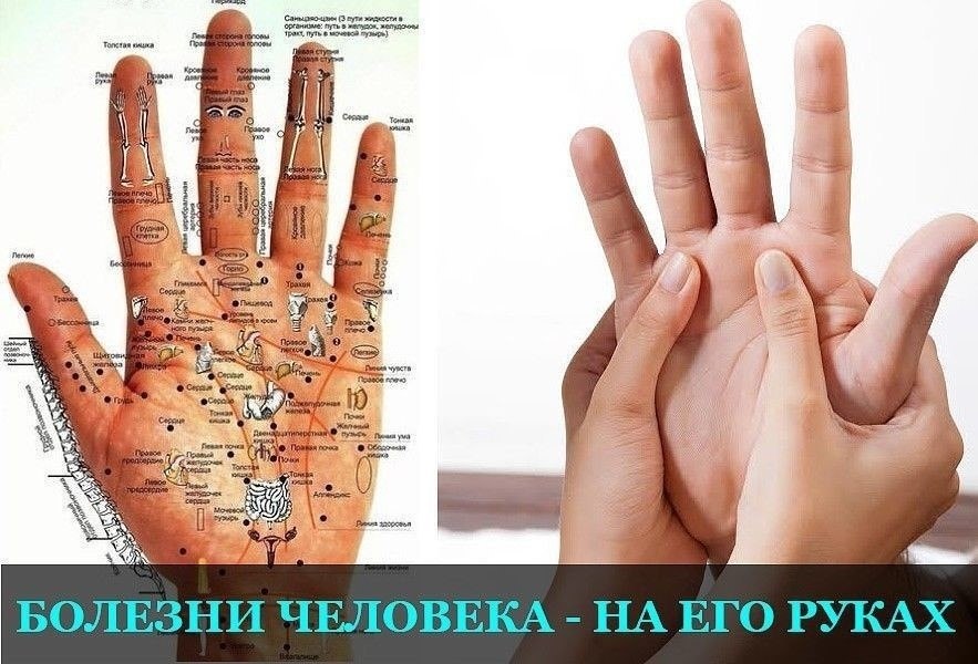 Ваши руки могут рассказать о здоровье: что следует знать. Как определить наличие заболеваний по рукам?