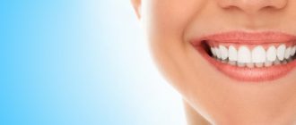 Узнайте, как не переплачивать за стоматологические услуги: полезные советы